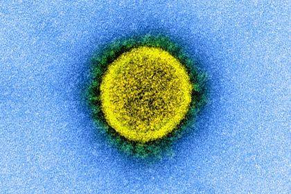 Ученые выявили самые уязвимые для коронавируса клетки человека - lenta.ru - США - Бостон