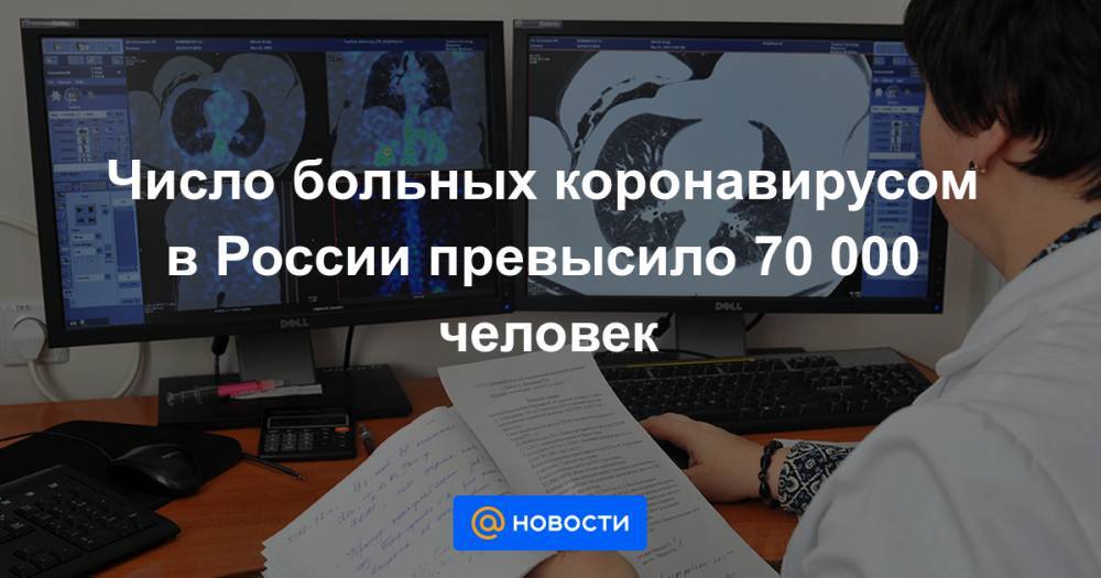 Число больных коронавирусом в России превысило 70 000 человек - news.mail.ru - Москва - Россия - Санкт-Петербург - Краснодарский край - Московская обл. - респ. Татарстан - Нижегородская обл. - Рязанская обл. - Алтайский край - респ. Дагестан - Мурманская обл. - Тульская обл.