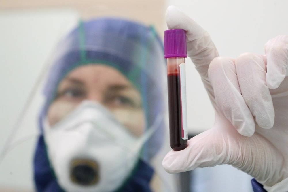 Более 25 тысяч тестов на коронавирус каждый день проводят в Москве - vm.ru - Москва - Россия