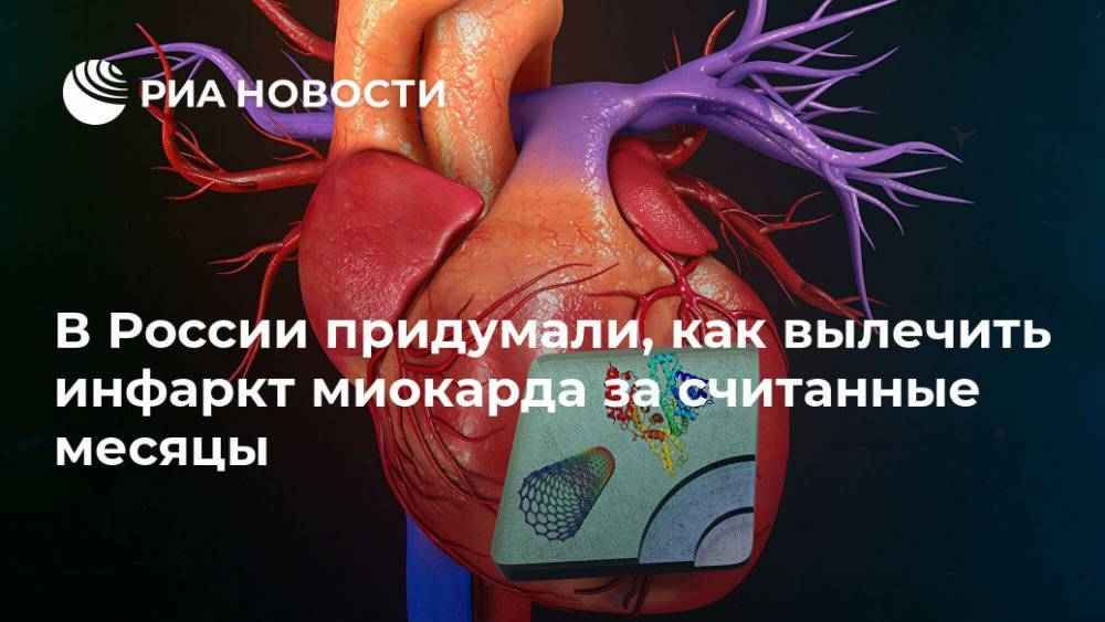 В России придумали, как вылечить инфаркт миокарда за считанные месяцы - ria.ru - Москва - Россия