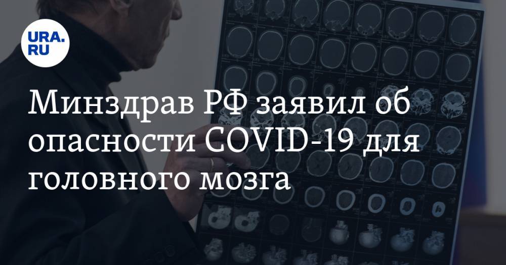 Минздрав РФ заявил об опасности COVID для головного мозга - ura.news - Россия - США - Сан-Диего