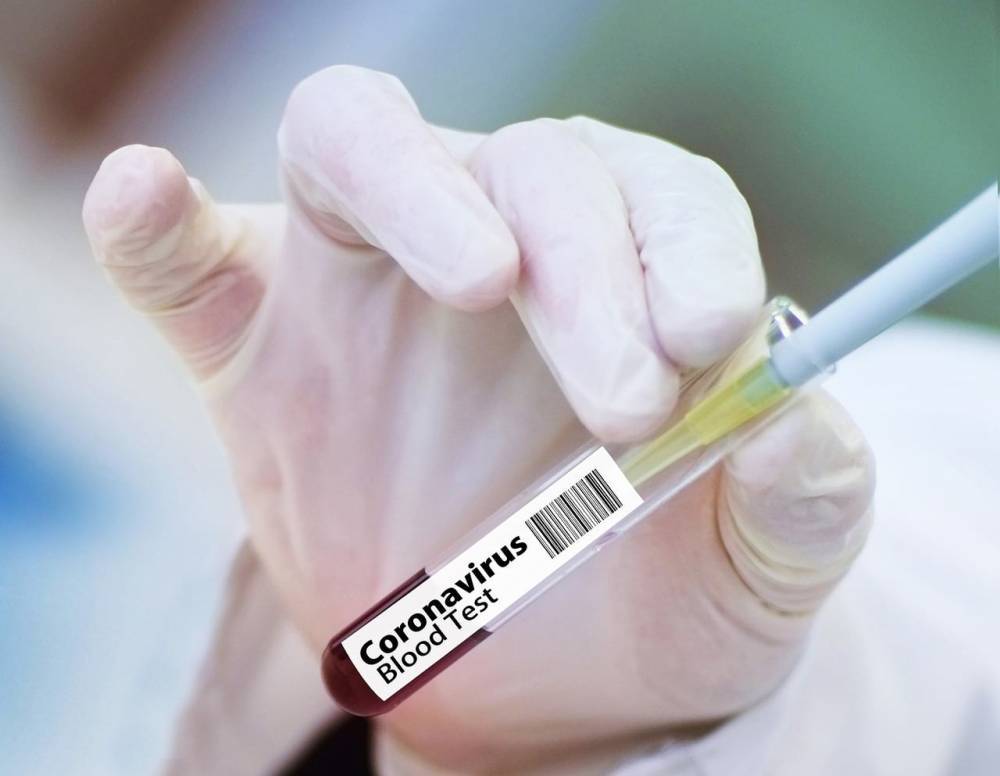 Ученые выяснили, от чего зависят симптомы COVID-19 - Cursorinfo: главные новости Израиля - cursorinfo.co.il - Израиль - Лондон