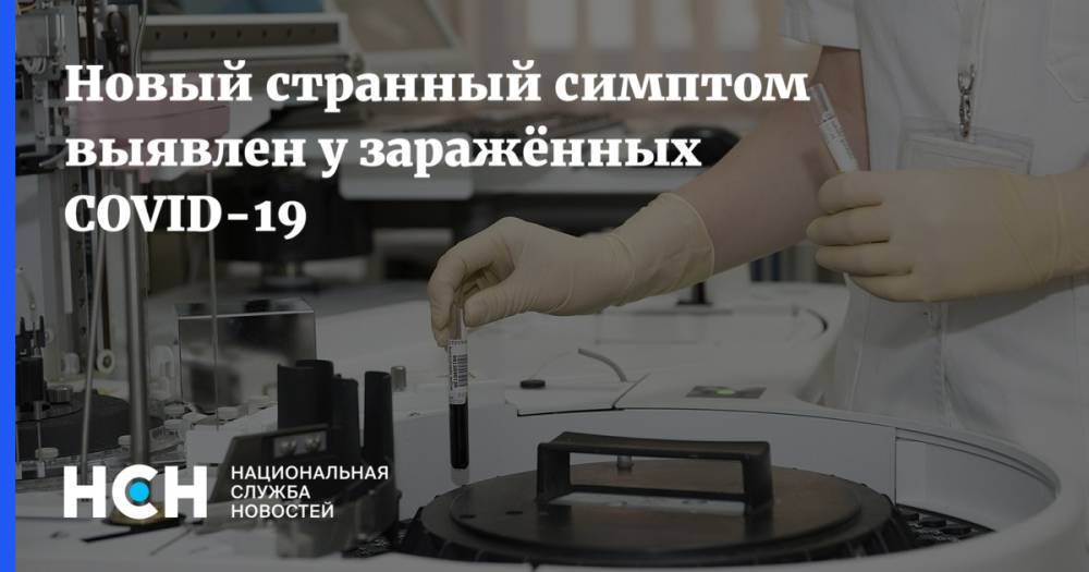 Денис Проценко - Новый странный симптом выявлен у заражённых COVID-19 - nsn.fm - Москва - Россия