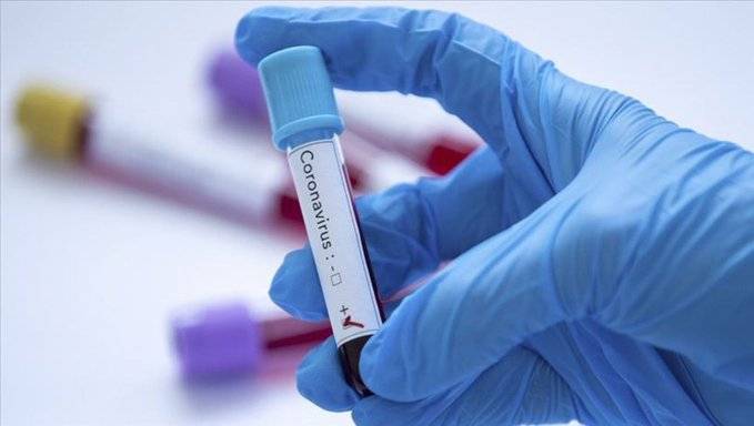 Биолог рассказала, почему тесты на коронавирус могут давать ошибочный результат - vm.ru - США