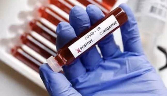 ВОЗ не удалось определить долю населения для развития иммунитета к коронавирусу - vm.ru - США