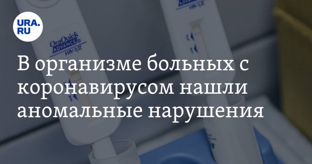 В организме больных с коронавирусом нашли аномальные нарушения - ura.news