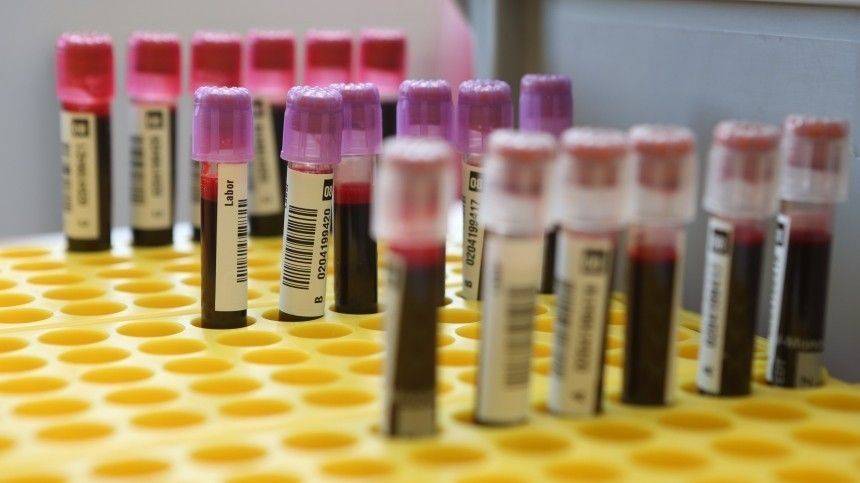 Вероника Скворцова - Вероника Скворцова назвала самую уязвимую для COVID-19 группу крови - 5-tv.ru
