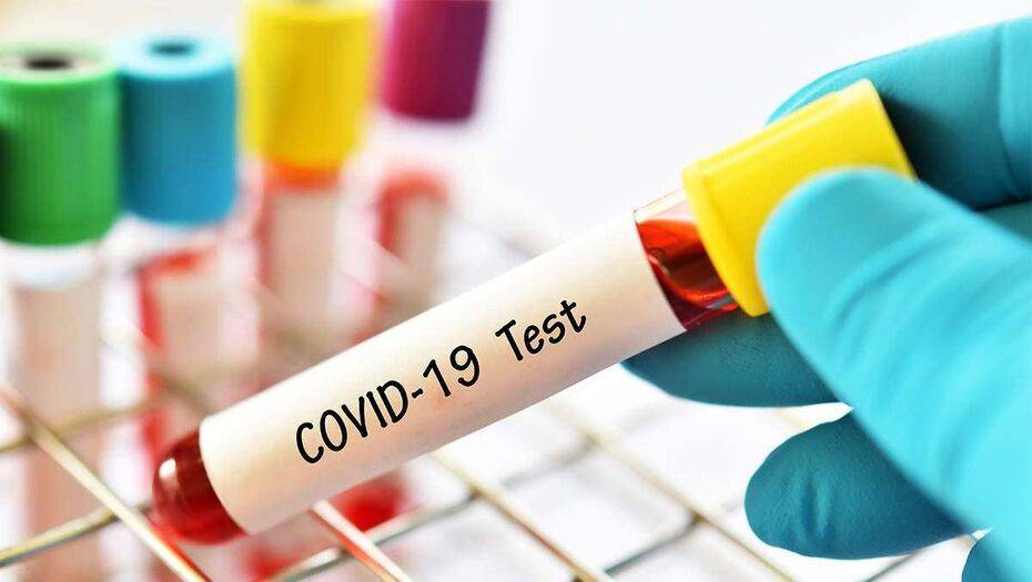 Джузеппе Конт - Covid-19 в мире: Италия откроет границы 3 июня, в Украине будут проводить массовое тестирование - informburo.kz - Украина - Италия