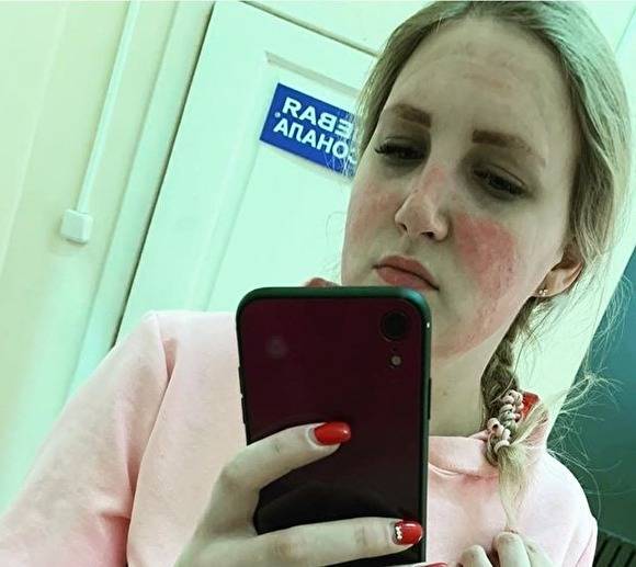 Во Владимирской области медсестра получила ожог лица после использования маски - newsland.com - Владимирская обл.