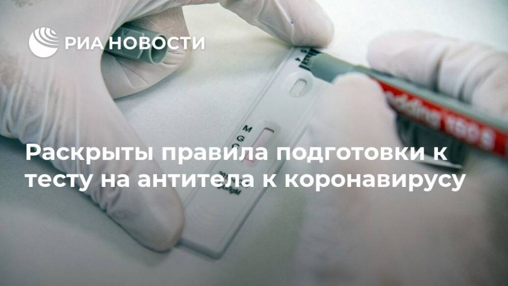 Раскрыты правила подготовки к тесту на антитела к коронавирусу - ria.ru - Москва - Россия