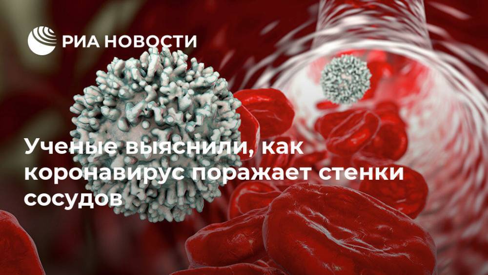 Швеция - Ученые выяснили, как коронавирус поражает стенки сосудов - ria.ru - Москва