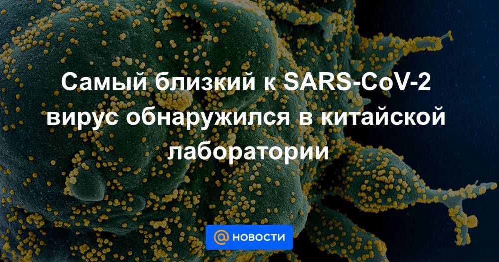 Михаил Щелканов - Самый близкий к SARS-CoV-2 вирус обнаружился в китайской лаборатории - news.mail.ru - Россия - Китай - США