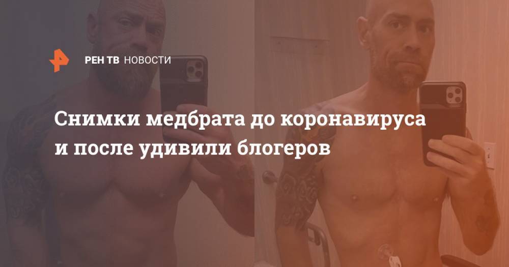 Снимки медбрата до коронавируса и после удивили блогеров - ren.tv - Сан-Франциско