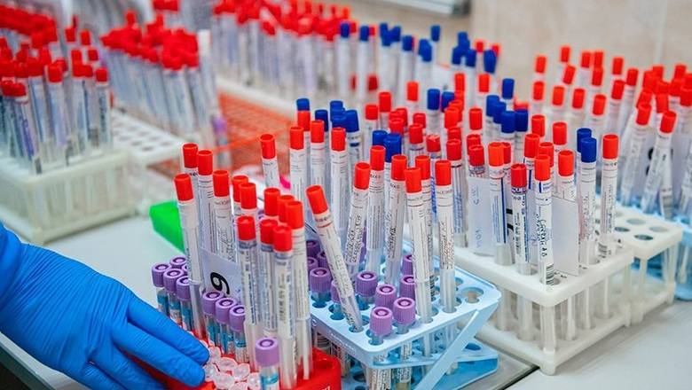 В частных лабораториях антитела к коронавирусу обнаружили у 14% россиян - newizv.ru - Москва - Московская обл. - ЦФО - окр.Сзфо