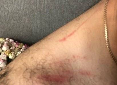 Предпринято служебное расследование по случаю применения насилия к гражданину в полиции Капана - news.am - Армения