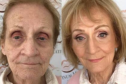 Спрятавший морщины макияж 80-летней пенсионерки поразил пользователей сети - lenta.ru - Шотландия