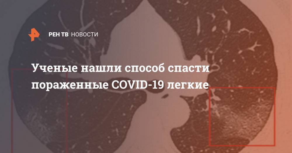 Ученые нашли способ спасти пораженные COVID-19 легкие - ren.tv