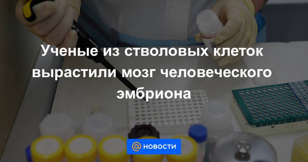 Ученые из стволовых клеток вырастили мозг человеческого эмбриона - news.mail.ru