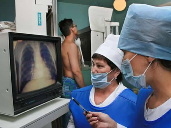 Повреждения легких, вызванные коронавирусом, могут оказаться необратимыми - nakanune.ru - Италия