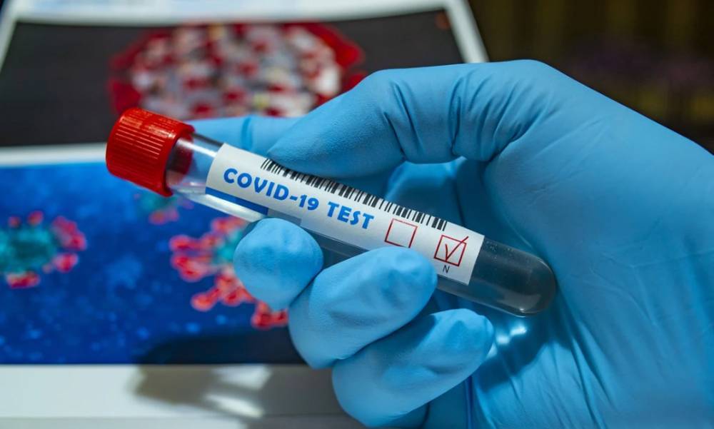 Владимир Арьев - Без массового тестирования на Covid-19 Украина всегда будет находиться в зоне риска — нардеп - prm.ua - Украина