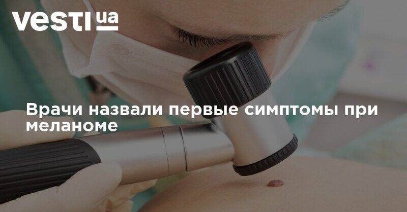 Андрей Каприн - Врачи назвали первые симптомы при меланоме - vesti.ua - Россия