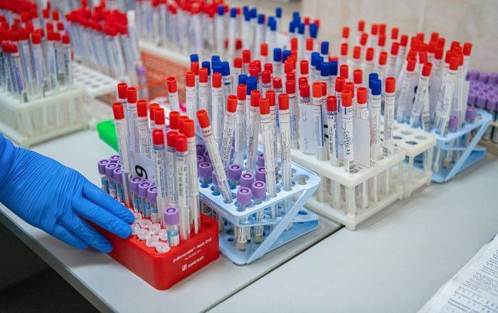 За сутки в Латвии выявлен один новый случай инфицирования COVID-19 - lv.sputniknews.ru - Рига - Латвия