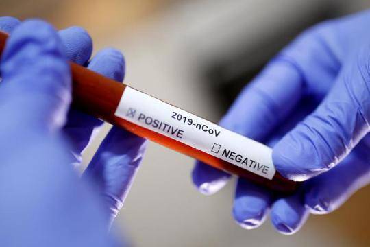 Джонс Хопкинс - Количество умерших от коронавируса в США превысило 77 тысяч человек - versia.ru - США