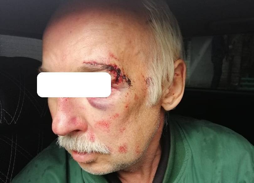 В Воронеже грабители в масках с пистолетам пробрались в дом к пенсионерам - moe-online.ru - Воронеж