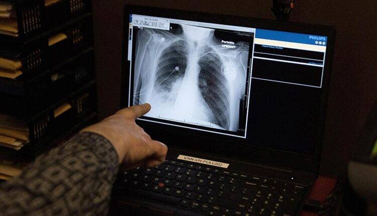 Чжун Наньшань - Китайский ученый назвал самое опасное свойство COVID-19 - newtvnews.ru - Китай