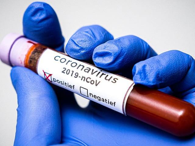 Статистика по заболеваемости COVID-19 в Челябинской области на 30 мая - u24.ru - Челябинская обл.