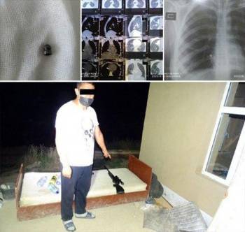 Пьяный охотник в Кашкадарье выстрелил в 20-летнюю девушку из ружья. Врачи спасли ее, достав пулю из сердца - podrobno.uz - Узбекистан - Ташкент