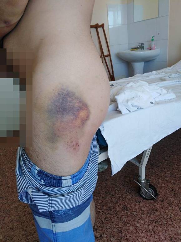 Сотрудник АО «УСТЭК-Челябинск» рассказал, как его на рабочем месте жестоко избил начальник - znak.com - Челябинск