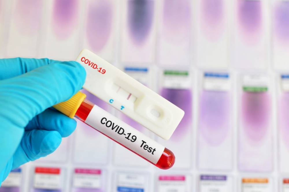 Игорь Сапожко - В Украине рекорд суточной заболеваемости COVID-19 за все время эпидемии - newsone.ua - Украина - Киев - Киевская обл. - Волынская обл. - Львовская обл.