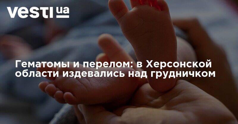 Гематомы и перелом: в Херсонской области издевались над грудничком - vesti.ua - Украина - Херсонская обл. - Херсонская Область