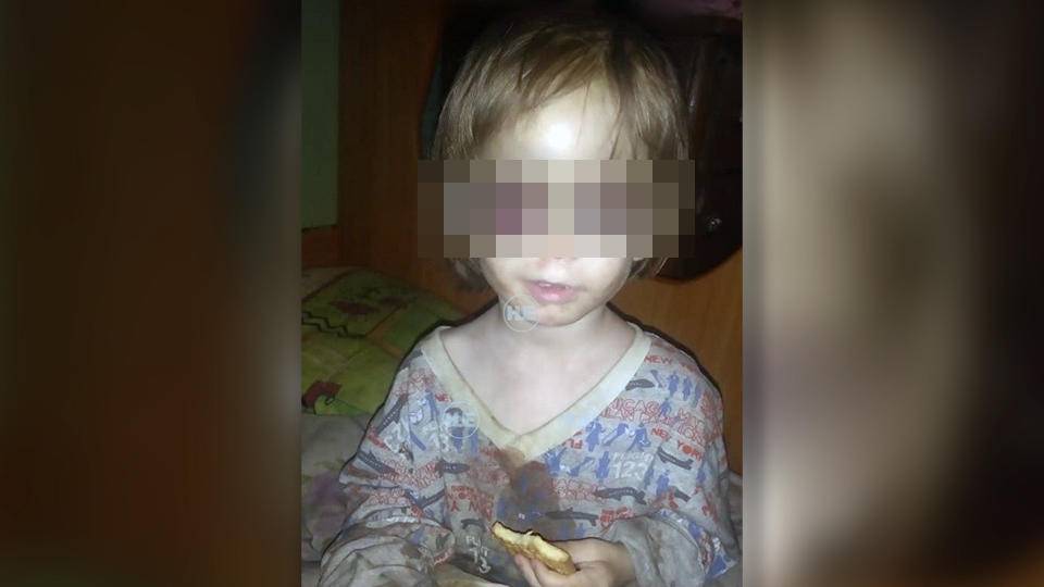 В Омске мать морила голодом, избивала и прятала ребенка от врачей - 7info.ru - Омск - Дачный