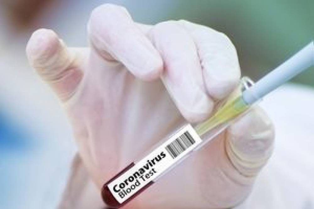ВОЗ: в мире разрабатываются 133 вакцины от COVID-19 - newsone.ua - Китай - США - Украина - Токио - Англия