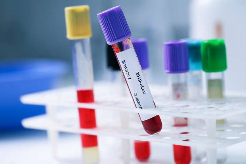 В Новой Зеландии две недели не фиксируют новых случаев COVID-19 - Cursorinfo: главные новости Израиля - cursorinfo.co.il - Израиль - Новая Зеландия