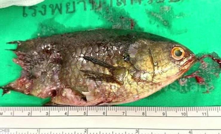 Еле спасли. В Таиланде рыба-ползун заползла в горло подростку и застряла - gomel.today - Таиланд