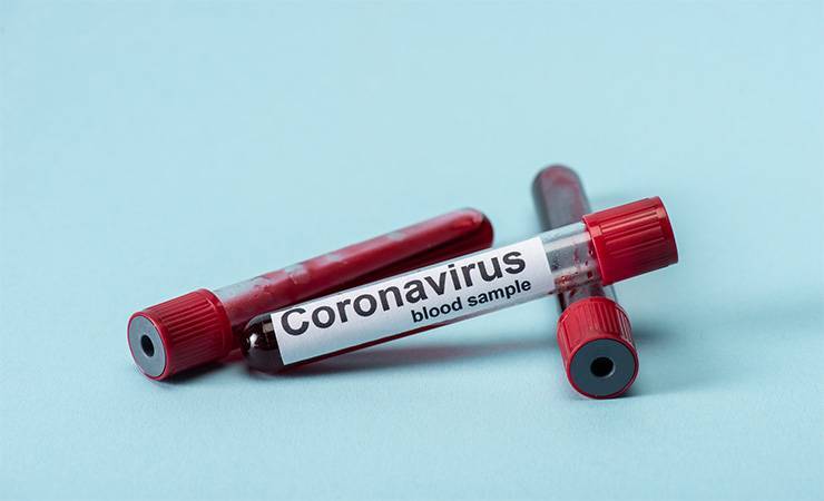 Джонс Хопкинс - В пятерке стран с наибольшим числом заболевших COVID-19 произошло изменение - gomel.today - Англия - Белоруссия - Индия - Испания
