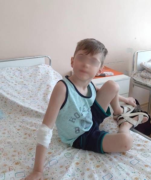 Тюменские врачи ОКБ №2 извлекли из легких пятилетнего ямальца деталь Лего - nakanune.ru - Тюменская обл.