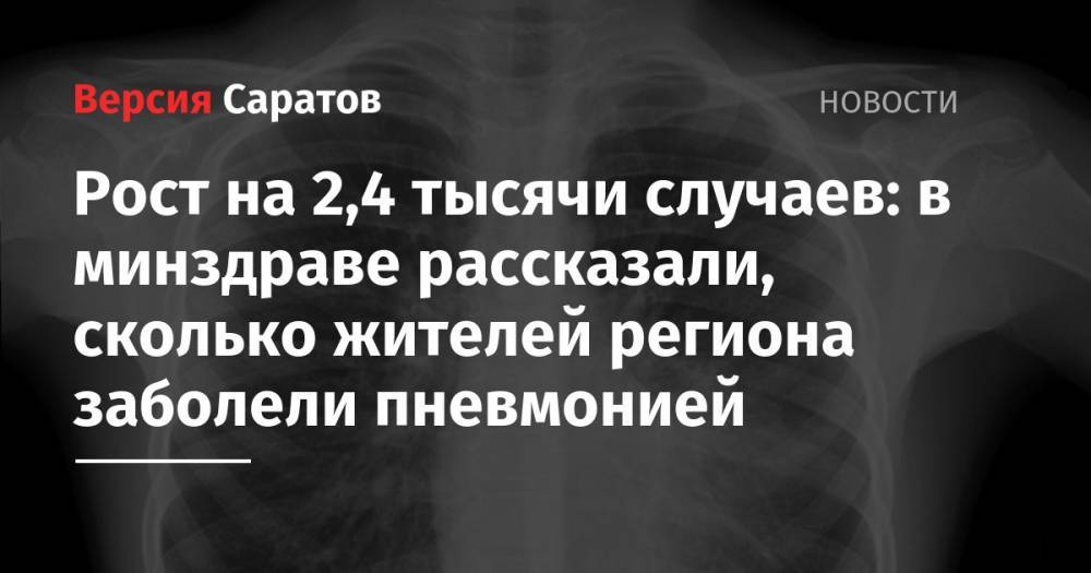 Александр Стрелюхин - Рост на 2,4 тысячи случаев: в минздраве рассказали, сколько жителей региона заболели пневмонией - nversia.ru - Саратовская обл.