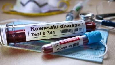 В Казахстане умерли двое детей от заболевания, схожего с синдромом Кавасаки - informburo.kz - Казахстан