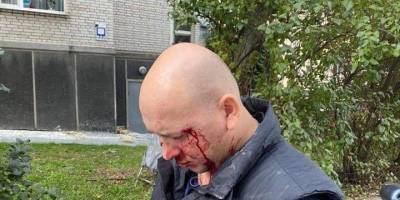 Иван Деев - В центре Киева избили ветерана АТО Деева, которого в декабре прошлого года освободили из плена - nv.ua - Киев