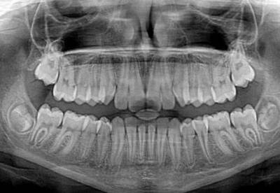 Ученые нашли в организме человека ранее неизвестные слюнные железы - facenews.ua - Украина - Голландия