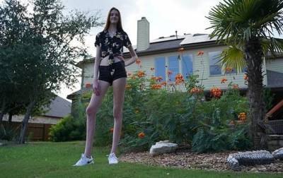 В США у девушки самые длинные ноги в мире - korrespondent.net - США - Англия - Франция - Остин - Лион