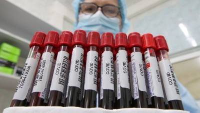 Коронавирус поставил рекорд по числу заболевших в сутки за все время пандемии - 5-tv.ru - Франция - Испания - Мадрид