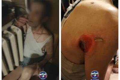 В Новосибирске мужчина во сне застрял в горячей батарее и серьезно пострадал - novos.mk.ru - Новосибирск