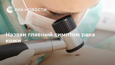 Назван главный симптом рака кожи - ria.ru - Москва - Англия