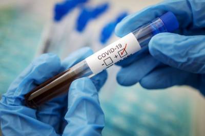 В одной из тихоокеанских стран выявили первого заболевшего коронавирусом COVID-19 - newsone.ua - США - Вануату