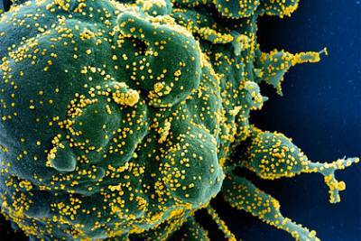 Зафиксированы новые бессимптомные случаи передачи коронавируса - lenta.ru - США - Нью-Йорк